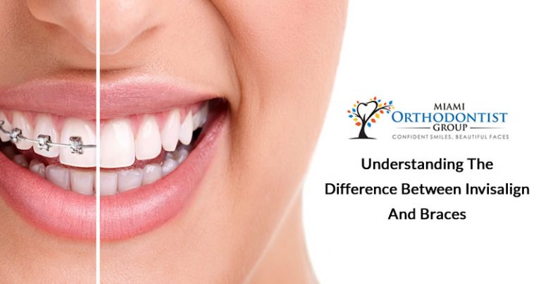 Understanding the Difference between Invisalign and Braces