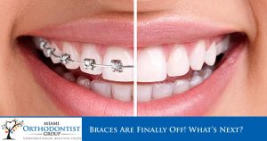 Braces Are Finally Off! What's Next