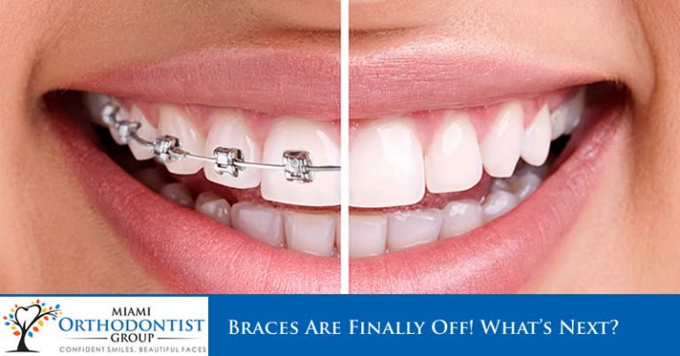Braces Are Finally Off! What's Next