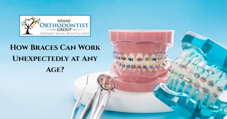 How Braces Can Work Unexpectedly at Any Age