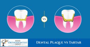 Dental Plaque vs Tartar