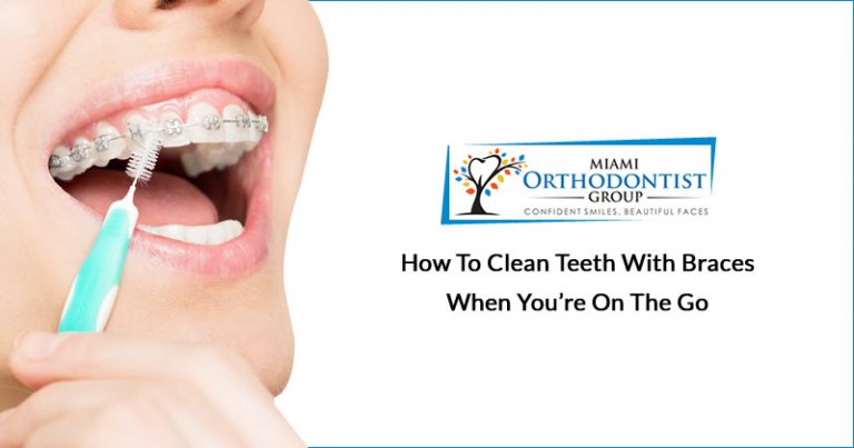 How to Clean Teeth with Braces When You're on the Go