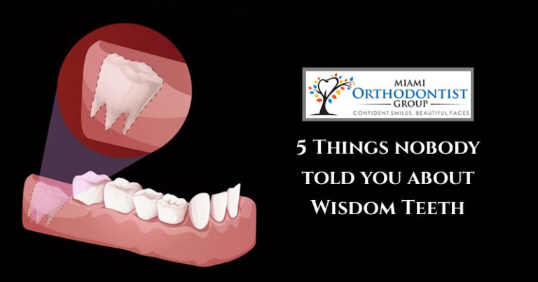 5 Things nobody told you about Wisdom Teeth