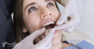 Everything You Need To Know About Invisalign