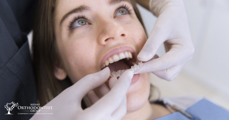 Everything You Need To Know About Invisalign