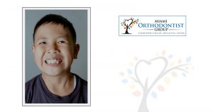 4 Ways Cosmetic Dentistry Can Fix Crooked Teeth