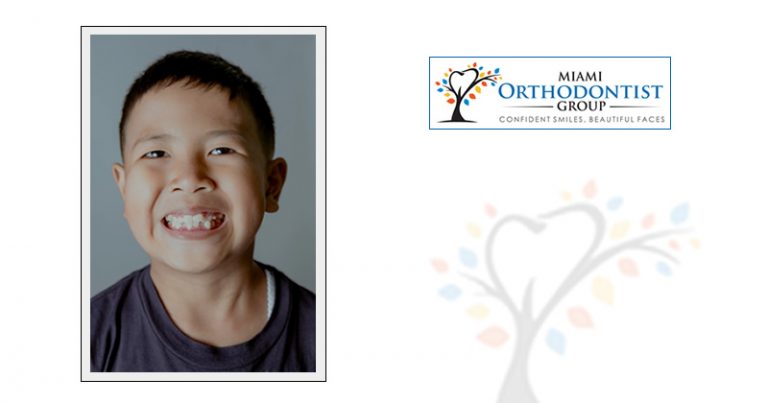 4 Ways Cosmetic Dentistry Can Fix Crooked Teeth