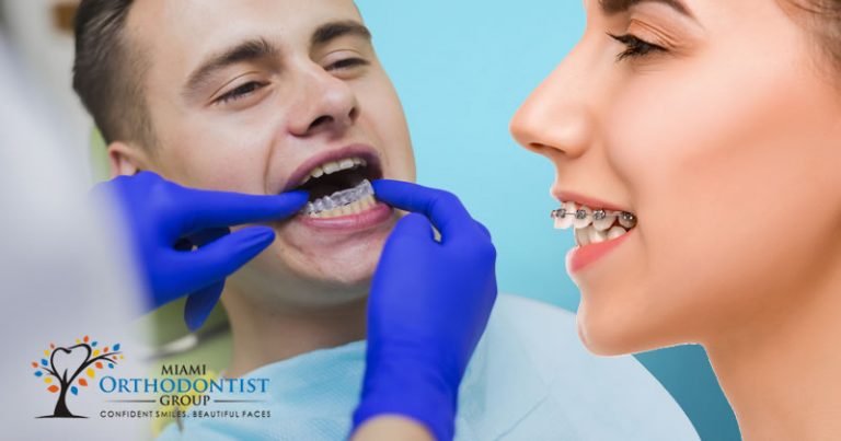 Braces Vs. Clear Aligners: Difference Cleared!