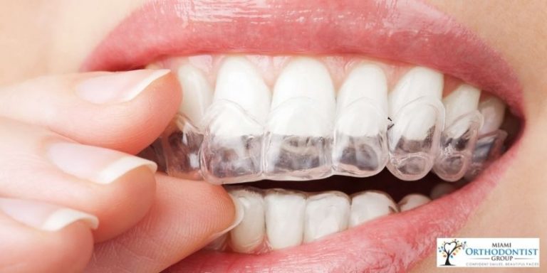invisalign doctors
