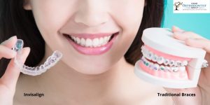 Invisalign Or Traditional Braces