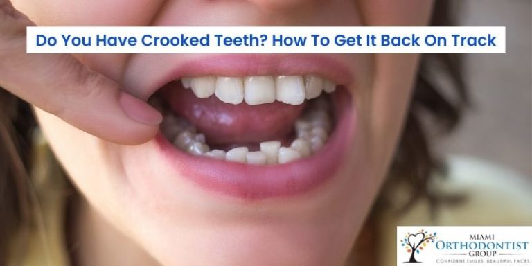 Crooked Teeth