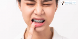 Orthodontic Emergencies and How to Handle Them