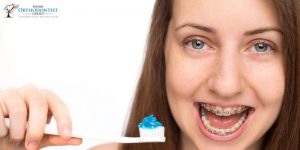 Orthodontic Treatment