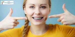 Orthodontic Treatment