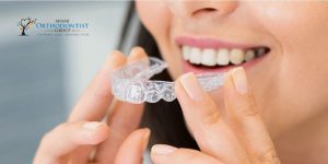 Invisalign