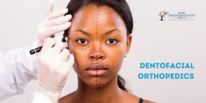 Dentofacial Orthopedics