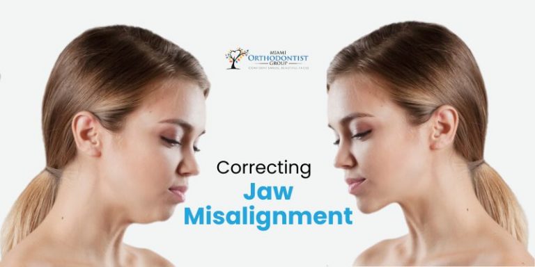 Jaw Misalignment