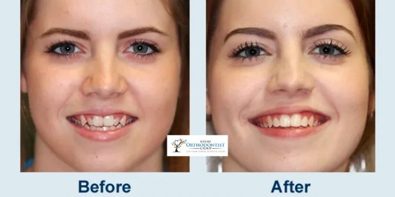 Dentofacial orthodontics