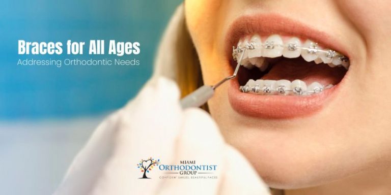 Braces for All Ages