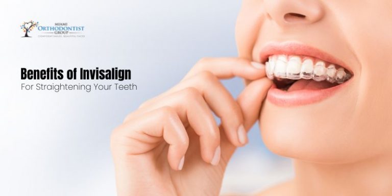 Benefits of Invisalign