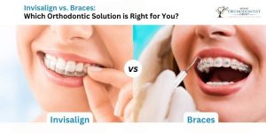 Invisalign vs Braces