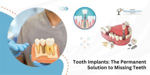 Tooth Implant