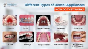 Different Types of Dental Appliances