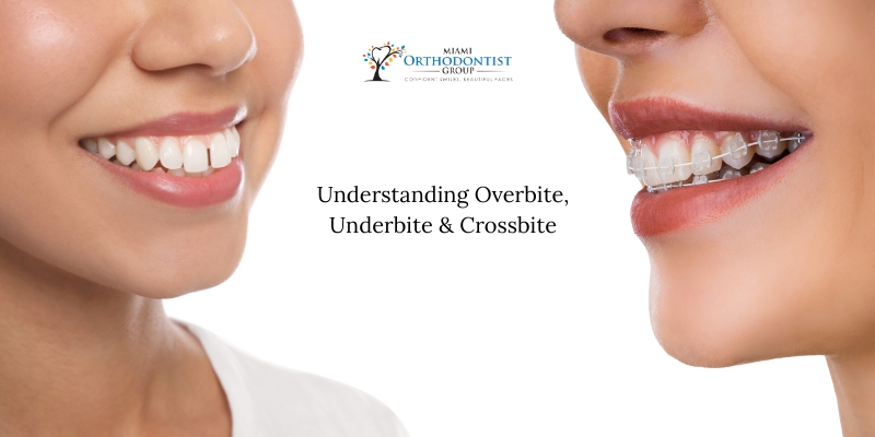 Miami Orthodontists Explain_ Overbite, Underbite, and Crossbite - Should You Be Concerned_ - 1