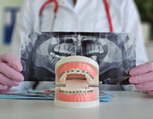 What are the Most Common Orthodontic Issues You Treat?