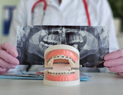 What are the Most Common Orthodontic Issues You Treat?