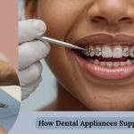 From Retainers to Expanders: How Dental Appliances Support Your Smile