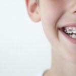 Why Early Orthodontic Treatment Matters for Your Child’s Smile?
